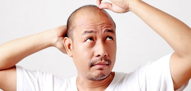 تقوية بصيلات الشعر