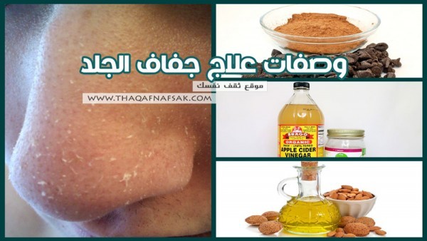 وصفات علاج جفاف الجلد ١٦ وصفة نتيجتها بعد أول استمعال وصفات علاج جفاف الجلد ١٦ وصفة نتيجتها بعد أول استمعال