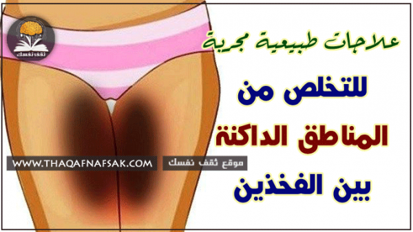 تفتيح المناطق الداكنة بين الفخذين تفتيح المناطق الداكنة بين الفخذين