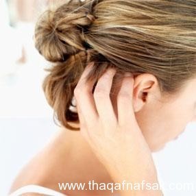 أفضل 10 علاجات طبيعية لقشرة الشعر أفضل 10 علاجات طبيعية لقشرة الشعر