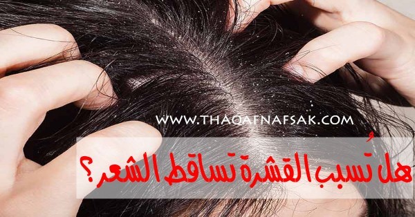هل تسبب القشرة تساقط الشعر والصلع ؟