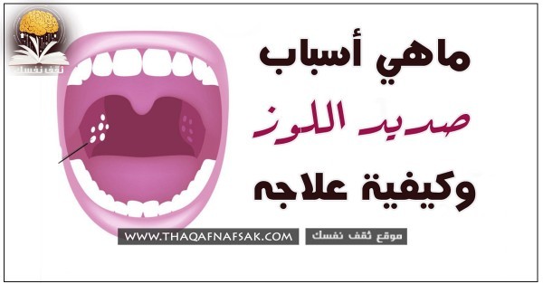 ماهي أسباب صديد اللوز وأعراضه وكيف يقدم الطبيب العلاج ؟