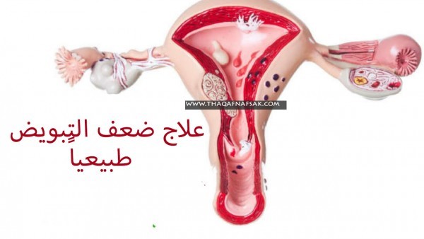 علاج ضعف التبويض ١١ طريقة طبيعية لزيادة فرص حدوث حمل