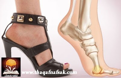 بالصور أسوأ الأحذية وأكثرها ضرراً على أقدامنا بالصور أسوأ الأحذية وأكثرها ضرراً على أقدامنا