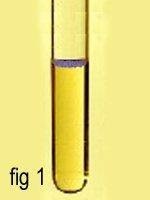 تعرف على صحتك من خلال لون بولك