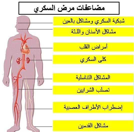 كل ما تريد معرفته عن مرض السكرى ..عوامل الخطورة و الأعراض و كيفية التعامل معه. كل ما تريد معرفته عن مرض السكرى ..عوامل الخطورة و الأعراض و كيفية التعامل معه.