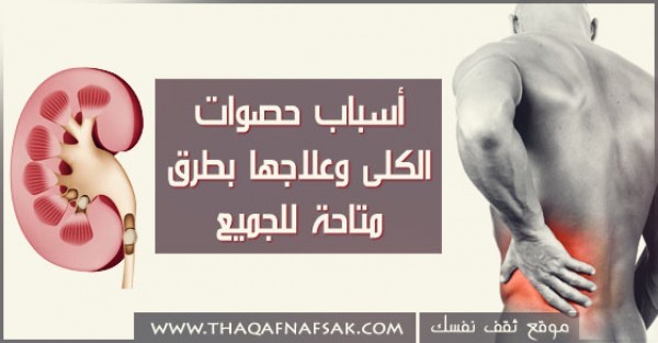 اسباب حصوات الكلى و علاجها بطرق متاحه للجميع اسباب حصوات الكلى و علاجها بطرق متاحه للجميع