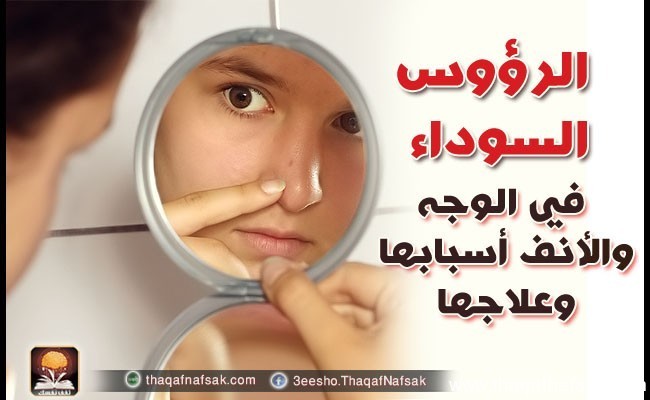 الرؤوس السوداء في الوجه والأنف أسبابها وعلاجها الرؤوس السوداء في الوجه والأنف أسبابها وعلاجها