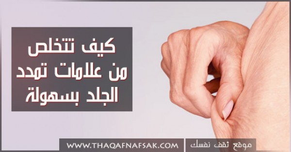 كيف اتخلص من الخطوط البيضاء في الجسم