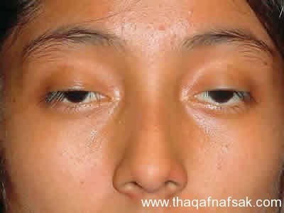 بالصور أسرار لا تعرفها كيف يتم فحص العين ؟ وكيف تفحص عينك بنفسك