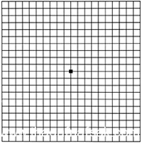 بالصور أسرار لا تعرفها كيف يتم فحص العين ؟ وكيف تفحص عينك بنفسك