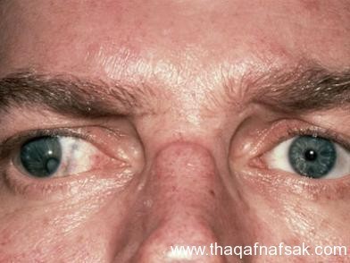 بالصور أسرار لا تعرفها كيف يتم فحص العين ؟ وكيف تفحص عينك بنفسك