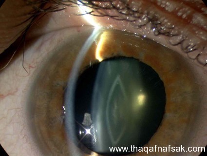 بالصور أسرار لا تعرفها كيف يتم فحص العين ؟ وكيف تفحص عينك بنفسك