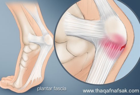 بالصور : اعرف صحتك من قدمك