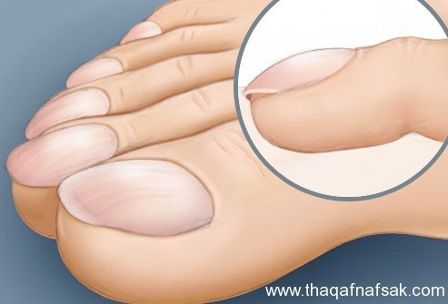 بالصور : اعرف صحتك من قدمك