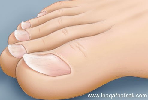 بالصور : اعرف صحتك من قدمك