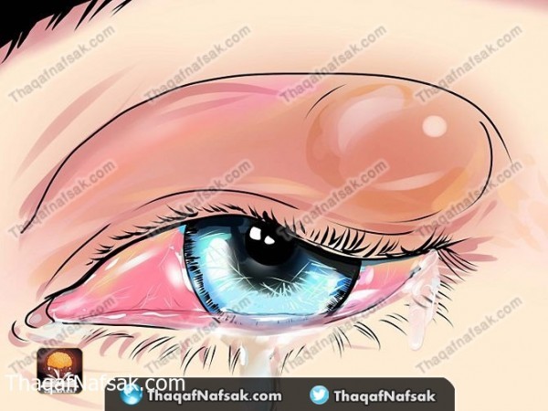 بالصور طريقة علاج دمل العين بطرق منزليه بالصور طريقة علاج دمل العين بطرق منزليه