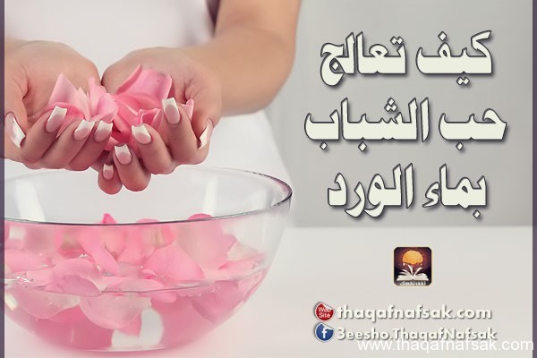 طريقة علاج حب الشباب بماء الورد طريقة علاج حب الشباب بماء الورد