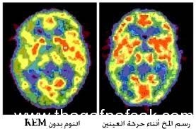 مراحل النوم مراحل النوم