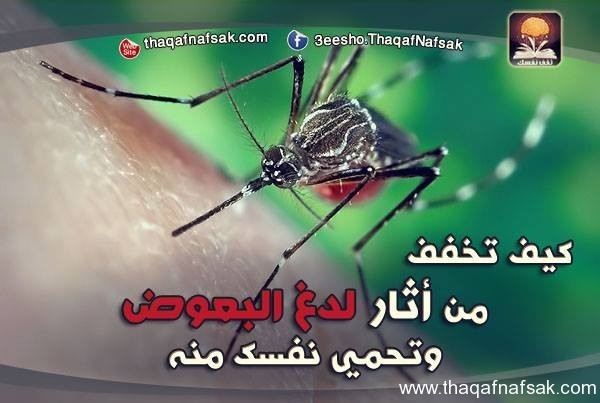 كيف تخفف من آثار لدغ البعوض وتحمي نفسك منه كيف تخفف من آثار لدغ البعوض وتحمي نفسك منه