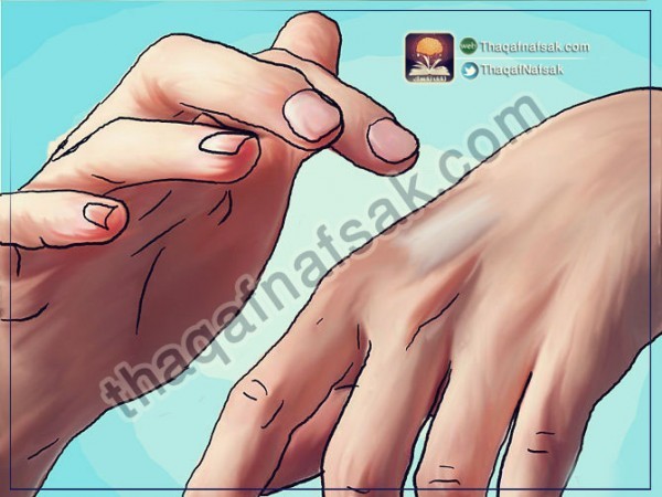 كيف تخفف من آثار لدغ البعوض وتحمي نفسك منه كيف تخفف من آثار لدغ البعوض وتحمي نفسك منه