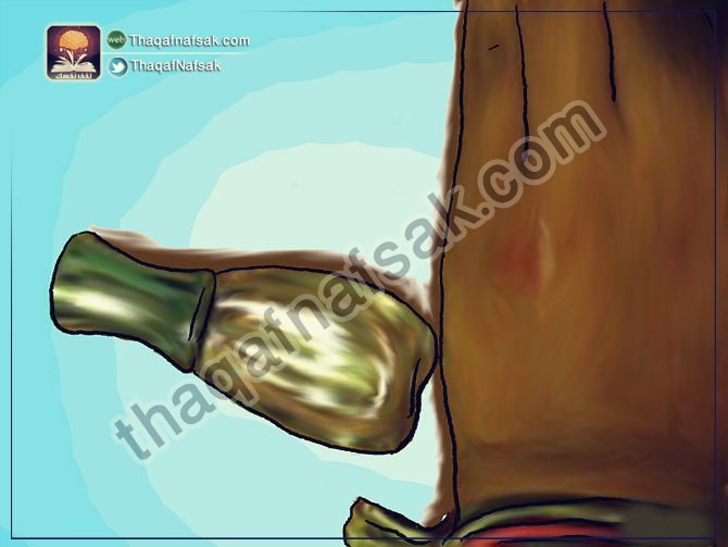 كيف تخفف من آثار لدغ البعوض وتحمي نفسك منه كيف تخفف من آثار لدغ البعوض وتحمي نفسك منه