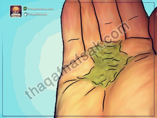 كيف تخفف من آثار لدغ البعوض وتحمي نفسك منه كيف تخفف من آثار لدغ البعوض وتحمي نفسك منه