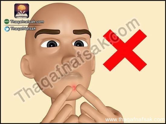 كيف تعالج حب الشباب بنفسك ؟ كيف تعالج حب الشباب بنفسك ؟