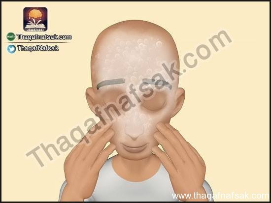 كيف تعالج حب الشباب بنفسك ؟ كيف تعالج حب الشباب بنفسك ؟