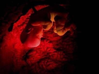 متحف لتفاصيل جسم الإنسان في هولندا – رحلة شبه حقيقة داخل جسمك لمعرفة أسراره متحف لتفاصيل جسم الإنسان في هولندا – رحلة شبه حقيقة داخل جسمك لمعرفة أسراره