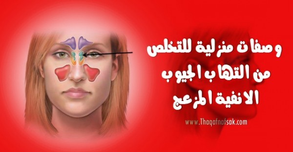 وصفات طبيعية لعلاج التهاب الجيوب الانفية مفيدة جدا وصفات طبيعية لعلاج التهاب الجيوب الانفية مفيدة جدا