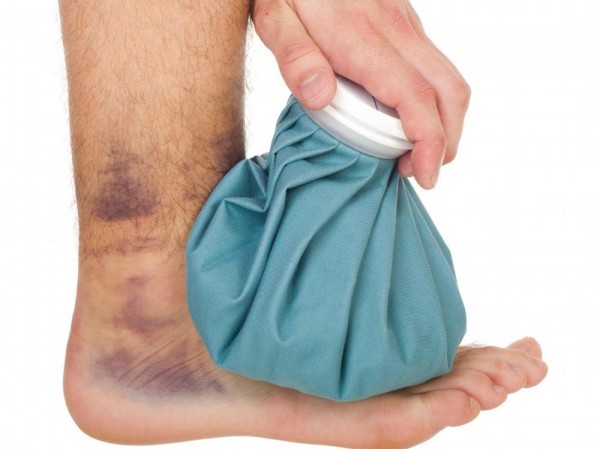 طرق طبيعية تستخدم في علاج الاصابات والكدمات بسهولة طرق طبيعية تستخدم في علاج الاصابات والكدمات بسهولة