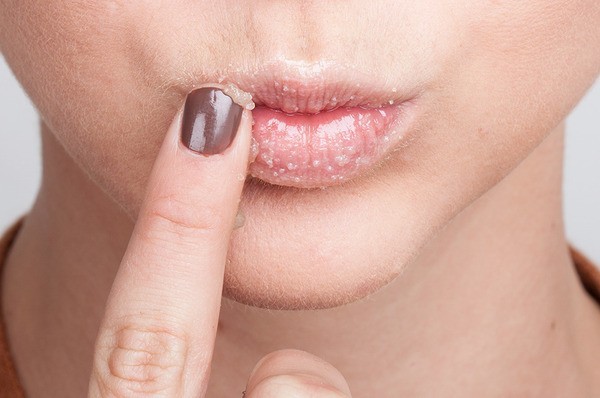 كيف اتخلص من الاسوداد حول الفم ٧ خطوات سريعة وسهلة كيف اتخلص من الاسوداد حول الفم ٧ خطوات سريعة وسهلة