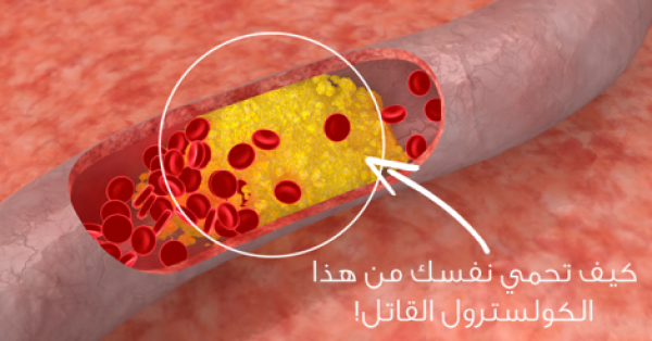 كيفية تقليل نسبة الكوليسترول في الدم ؟ نصائح منزلية سهلة كيفية تقليل نسبة الكوليسترول في الدم ؟ نصائح منزلية سهلة