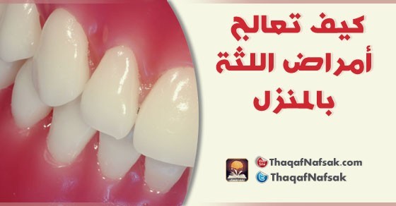 كيف تعالج أمراض اللثة بالمنزل كيف تعالج أمراض اللثة بالمنزل