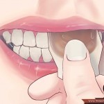 كيف تعالج أمراض اللثة بالمنزل كيف تعالج أمراض اللثة بالمنزل