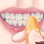 كيف تعالج أمراض اللثة بالمنزل كيف تعالج أمراض اللثة بالمنزل