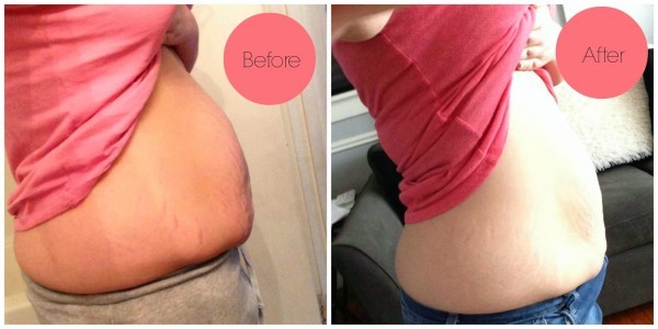 نصائح دكتور أوز لتفتيت دهون البطن والتخلص من الكرش