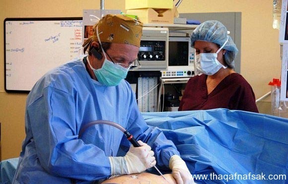 معلومات عن عملية شفط الدهون معلومات عن عملية شفط الدهون