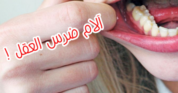 ١٠ مسكنات من صنع يديك لعلاج آلام ضرس العقل نهائي ١٠ مسكنات من صنع يديك لعلاج آلام ضرس العقل نهائي