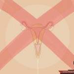 أحذرن أسباب الإجهاض المتكرر و كيف تتصرفن بعده ؟