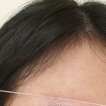 بالصور طرق إزالة الشعر بالخيط بنفسك من كل أماكن الجسم بالصور طرق إزالة الشعر بالخيط بنفسك من كل أماكن الجسم