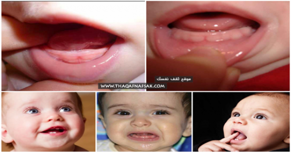 مرحلة تسنين الأطفال أعراضها وكيفية التعامل معها مرحلة تسنين الأطفال أعراضها وكيفية التعامل معها