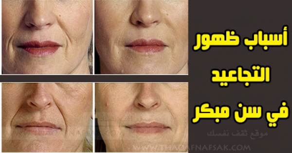 9 عادات خاطئة تسبب ظهور التجاعيد في سن مبكر 9 عادات خاطئة تسبب ظهور التجاعيد في سن مبكر