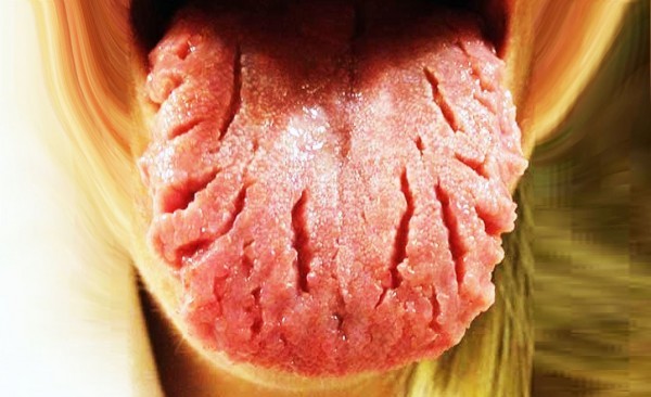 ١٠ طرق طبيعية منزلية لعلاج تشقق اللسان ١٠ طرق طبيعية منزلية لعلاج تشقق اللسان