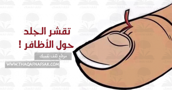 أسباب جفاف وتقشر الجلد حول الأظافر وكيفية علاجه أسباب جفاف وتقشر الجلد حول الأظافر وكيفية علاجه