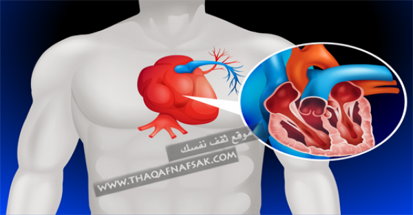 علاج انسداد الشرايين بمجموعة نصائح وطرق منزلية