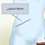 ﻿كيفية الكشف عن التهاب الزائدة الدودية أثناء الحمل