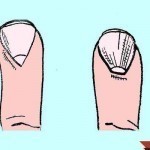 ماذا تقول شكل اظافرك عن شخصيتك وصحتك بالصور ؟