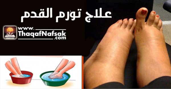 علاج أنتفاخ وتورم القدم أبرز الطرق الجديدة